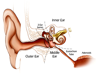 hearing-surgery-stapedectomy
